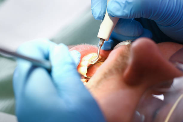 Best Tooth Pain Emergency Relief  in New Concord, OH