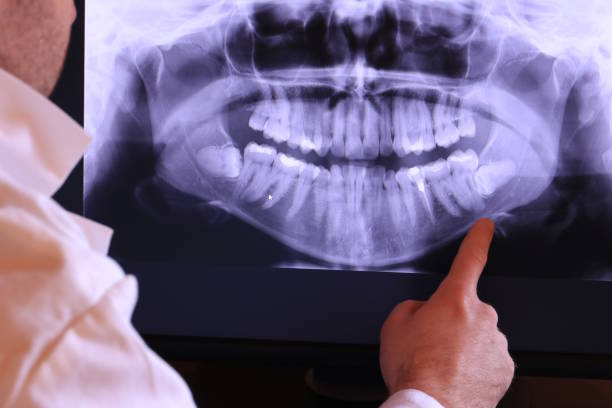 Best Tooth Infection Emergency Dentist  in New Concord, OH